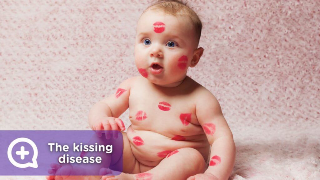 kissing disease post 1200x675 1
